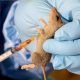 Lassa Fever killed 102 persons in 2021 - NCDC